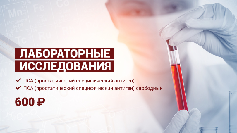 Ce inseamna PSA (Antigenul specific prostatic) | webtask.ro